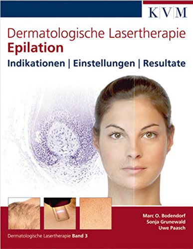 Dermatologische Lasertherapie Band 3: Epilation:...